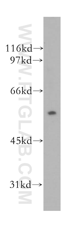 Western Blot (WB) analysis of Jurkat cells using TRIM15 Polyclonal antibody (13623-1-AP)