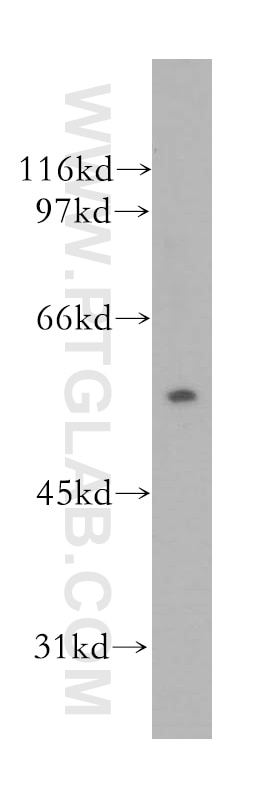 WB analysis of Jurkat using 13623-1-AP