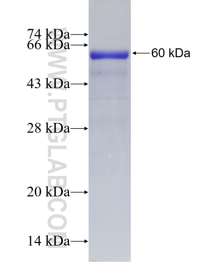 TRIM15 fusion protein Ag4533 SDS-PAGE