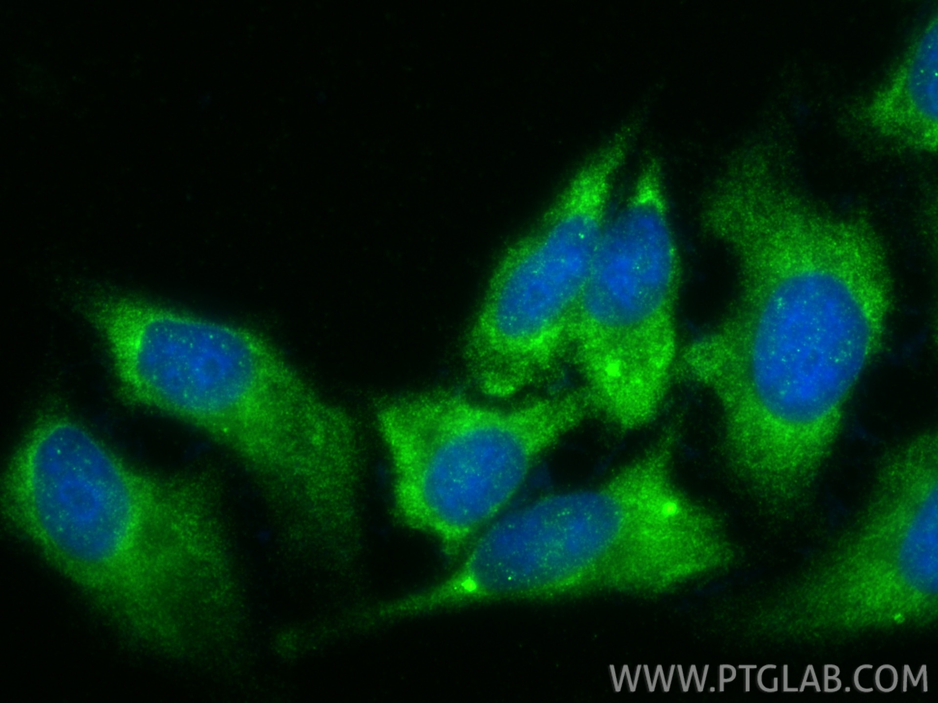 Immunofluorescence (IF) / fluorescent staining of HepG2 cells using TRIM16 Polyclonal antibody (24403-1-AP)