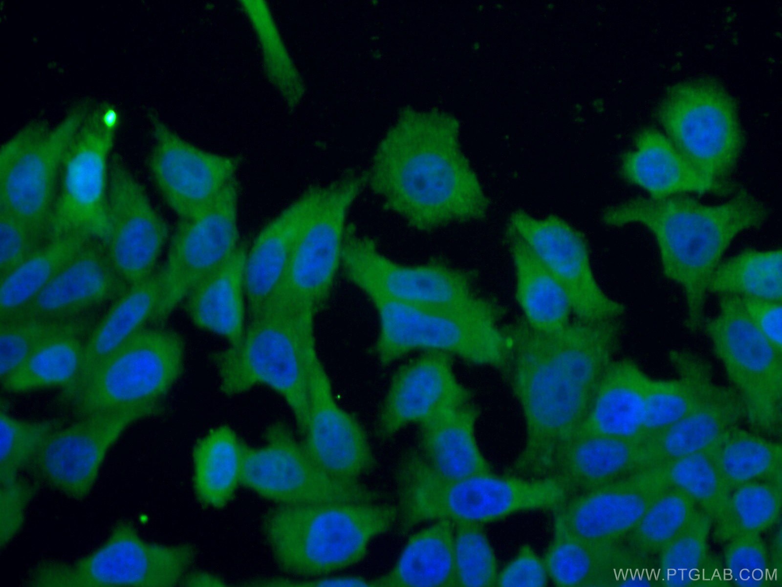 Immunofluorescence (IF) / fluorescent staining of HepG2 cells using TRIM16 Polyclonal antibody (24403-1-AP)