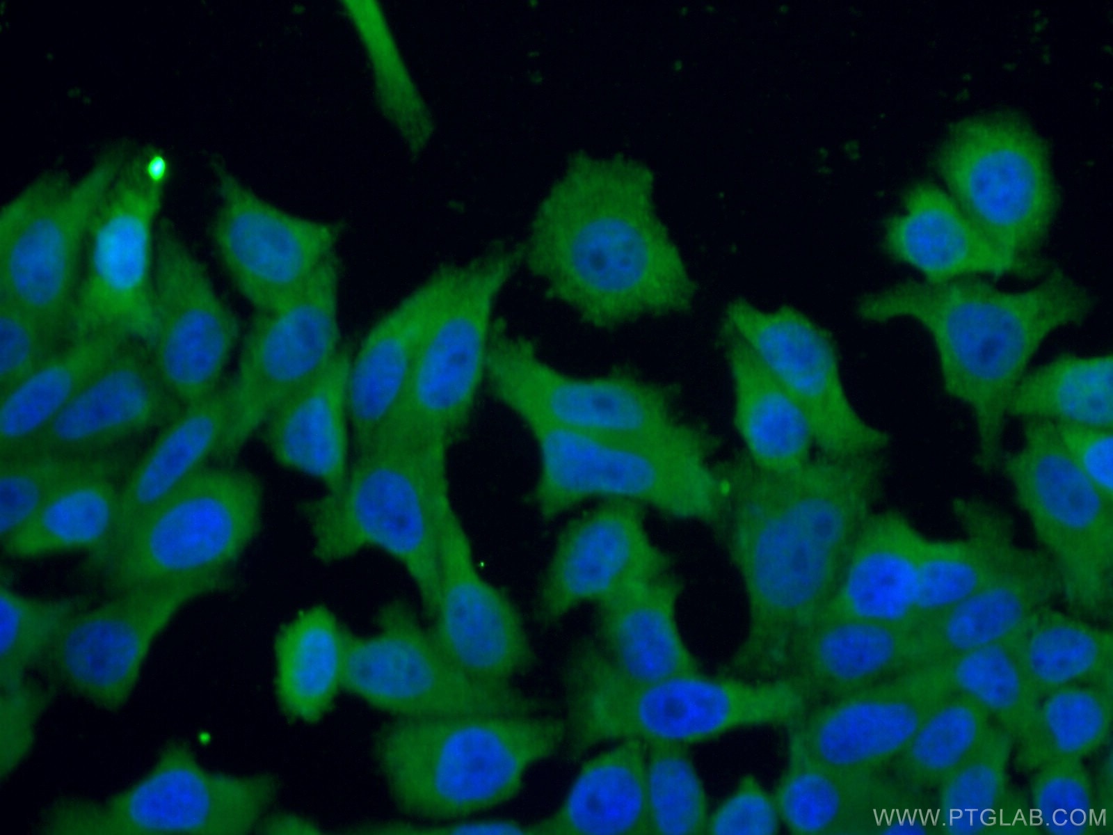 Immunofluorescence (IF) / fluorescent staining of HepG2 cells using TRIM16 Polyclonal antibody (24403-1-AP)