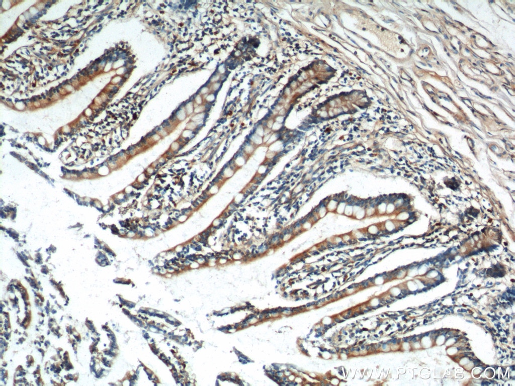 Immunohistochemistry (IHC) staining of human small intestine tissue using TRIM16 Polyclonal antibody (24403-1-AP)