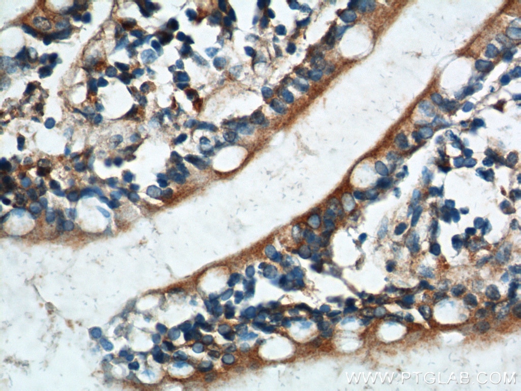 Immunohistochemistry (IHC) staining of human small intestine tissue using TRIM16 Polyclonal antibody (24403-1-AP)