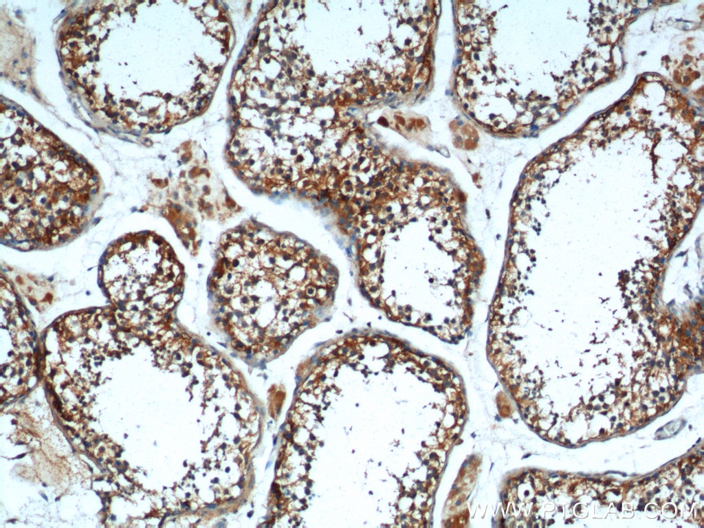 Immunohistochemistry (IHC) staining of human testis tissue using TRIM16 Polyclonal antibody (24403-1-AP)