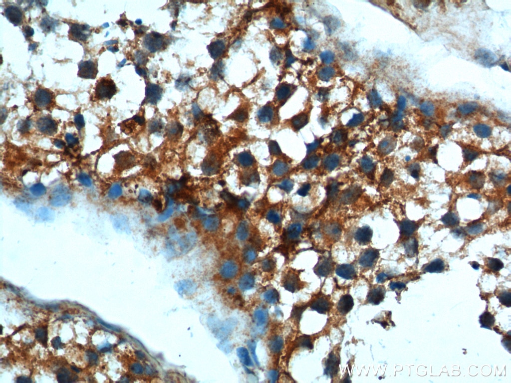 Immunohistochemistry (IHC) staining of human testis tissue using TRIM16 Polyclonal antibody (24403-1-AP)