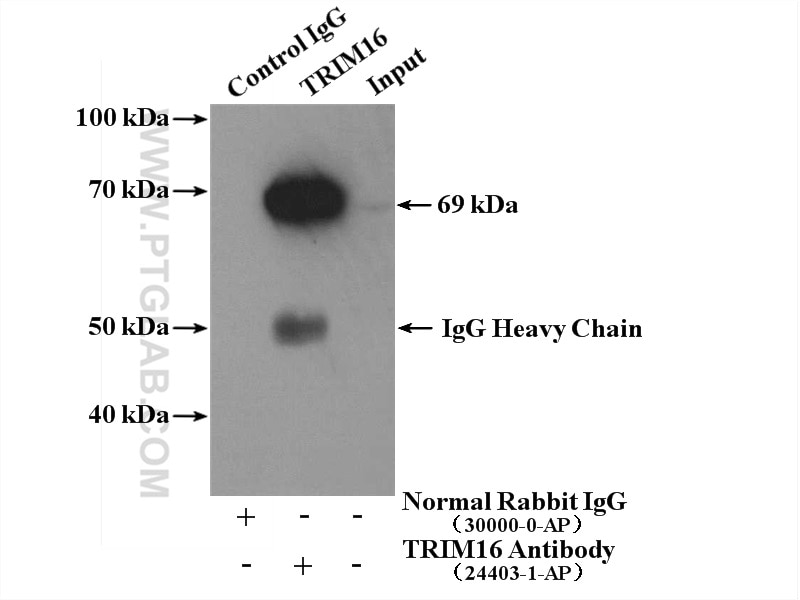 Immunoprecipitation (IP) experiment of HeLa cells using TRIM16 Polyclonal antibody (24403-1-AP)