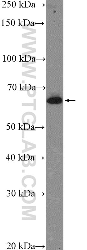 Western Blot (WB) analysis of HepG2 cells using TRIM16 Polyclonal antibody (24403-1-AP)