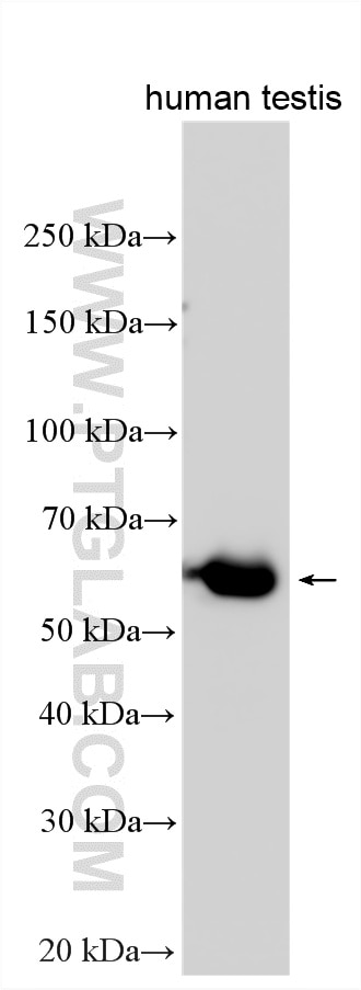 Western Blot (WB) analysis of various lysates using TRIM16 Polyclonal antibody (24403-1-AP)
