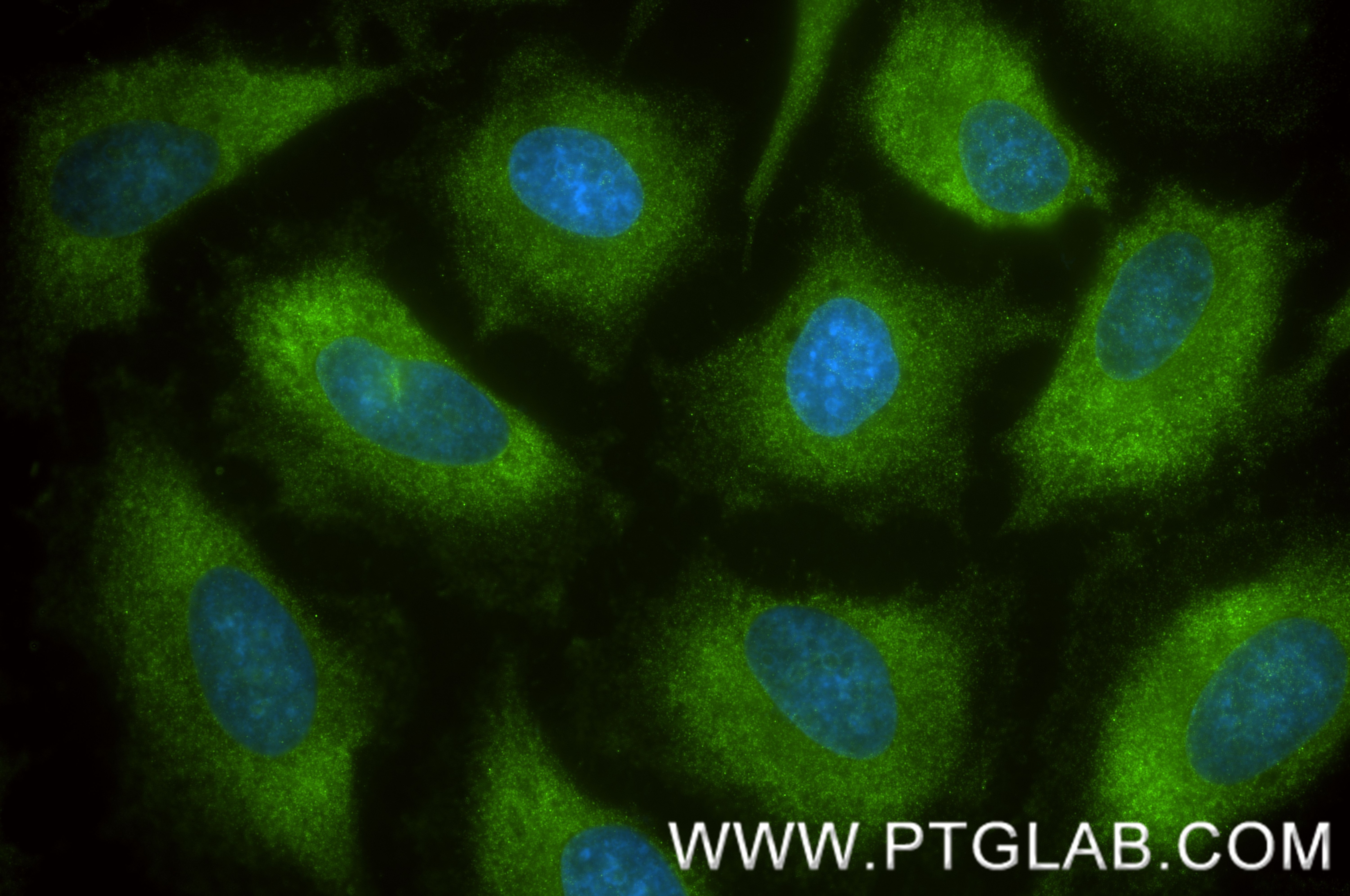 IF Staining of HeLa using 87377-3-RR (same clone as 87377-3-PBS) Immunofluorescence (IF) / fluorescent staining of HeLa cells using TRIM16 Recombinant monoclonal antibody (87377-3-RR)