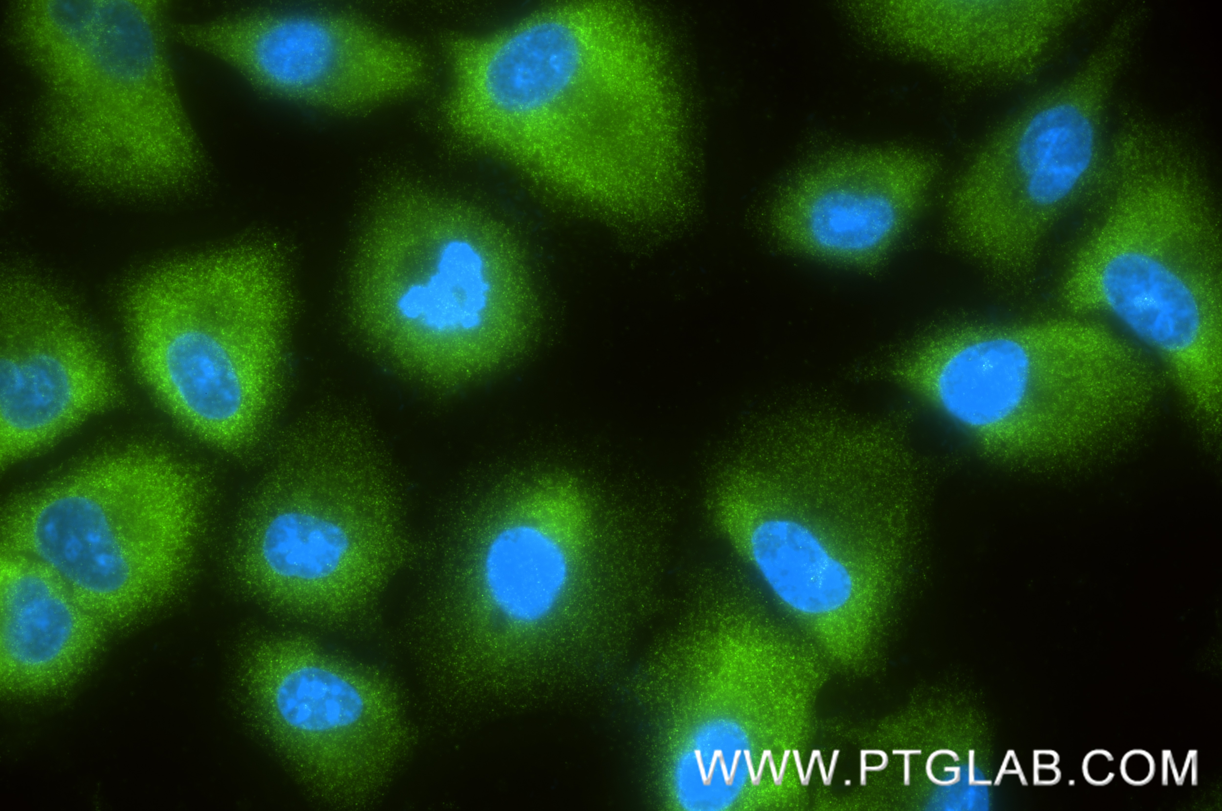 IF Staining of A549 using 87377-3-RR (same clone as 87377-3-PBS) Immunofluorescence (IF) / fluorescent staining of A549 cells using TRIM16 Recombinant monoclonal antibody (87377-3-RR)