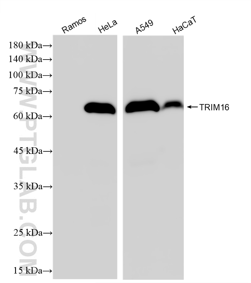 WB analysis using 87377-3-RR (same clone as 87377-3-PBS) Western Blot (WB) analysis of various lysates using TRIM16 Recombinant monoclonal antibody (87377-3-RR)
