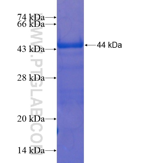 TRIM16 fusion protein Ag21406 SDS-PAGE