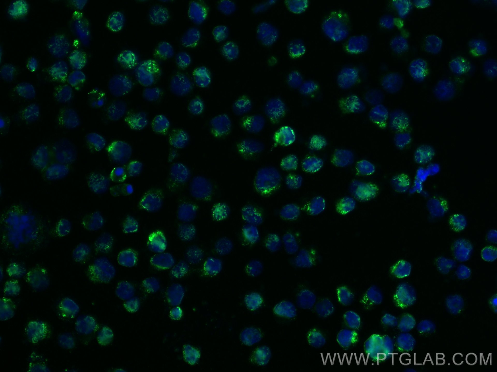 Immunofluorescence (IF) / fluorescent staining of COLO 320 cells using TRIM17 Polyclonal antibody (13663-1-AP)
