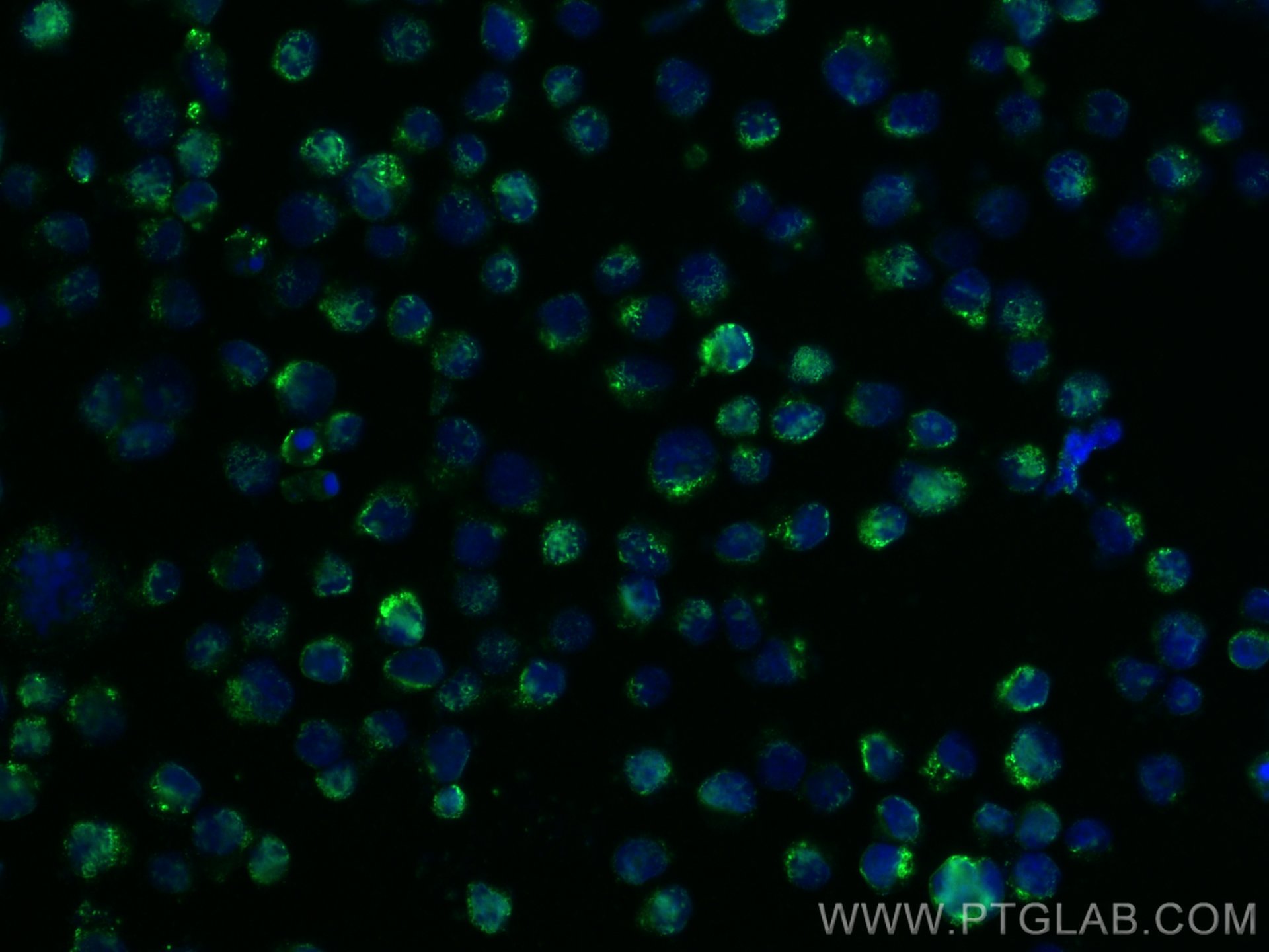 IF Staining of COLO 320 using 13663-1-AP