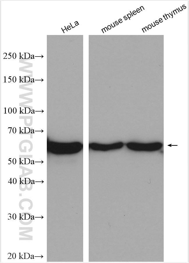Western Blot (WB) analysis of various lysates using TRIM17 Polyclonal antibody (13663-1-AP)