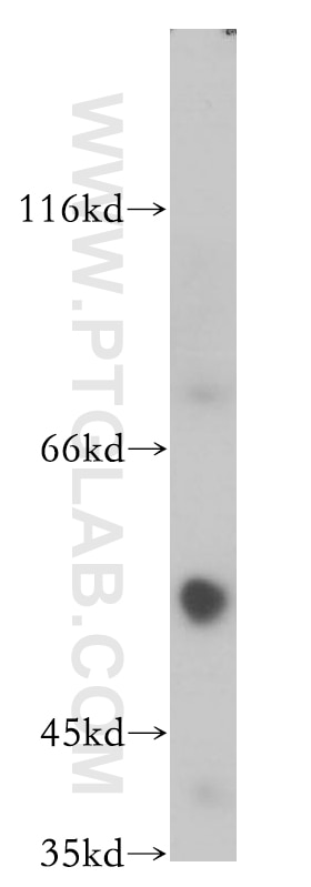 Western Blot (WB) analysis of COLO 320 cells using TRIM17 Polyclonal antibody (13663-1-AP)