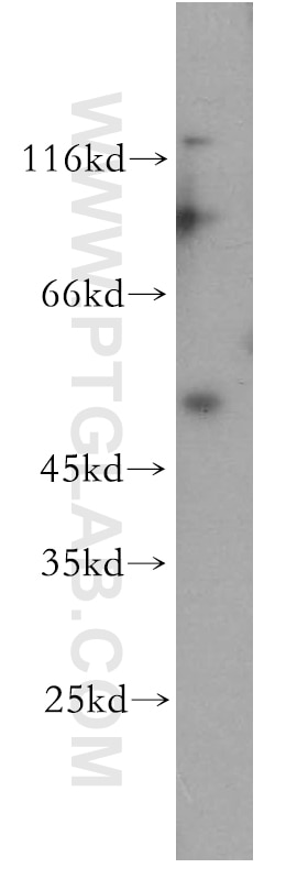 Western Blot (WB) analysis of HeLa cells using TRIM17 Polyclonal antibody (13663-1-AP)