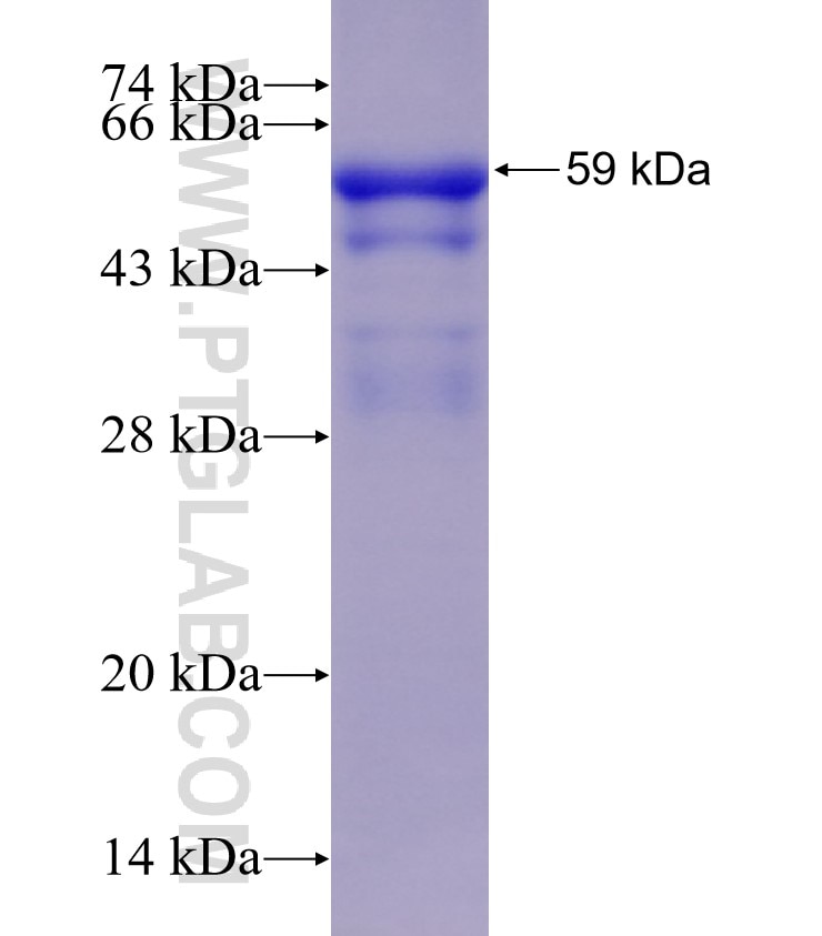 TRIM17 fusion protein Ag4572 SDS-PAGE