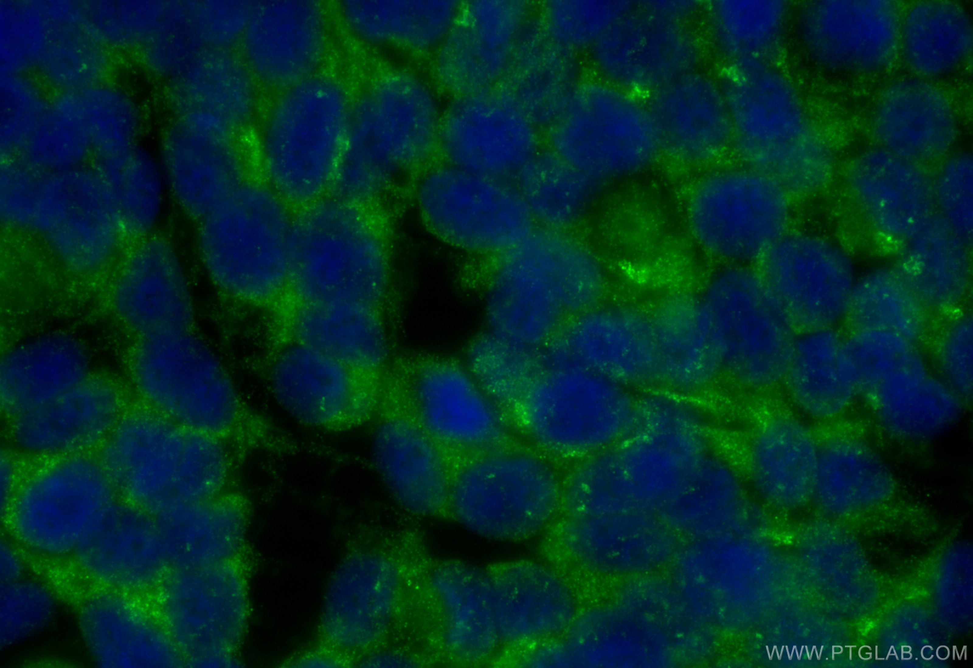 Immunofluorescence (IF) / fluorescent staining of SH-SY5Y cells using TRIM2 Polyclonal antibody (20356-1-AP)