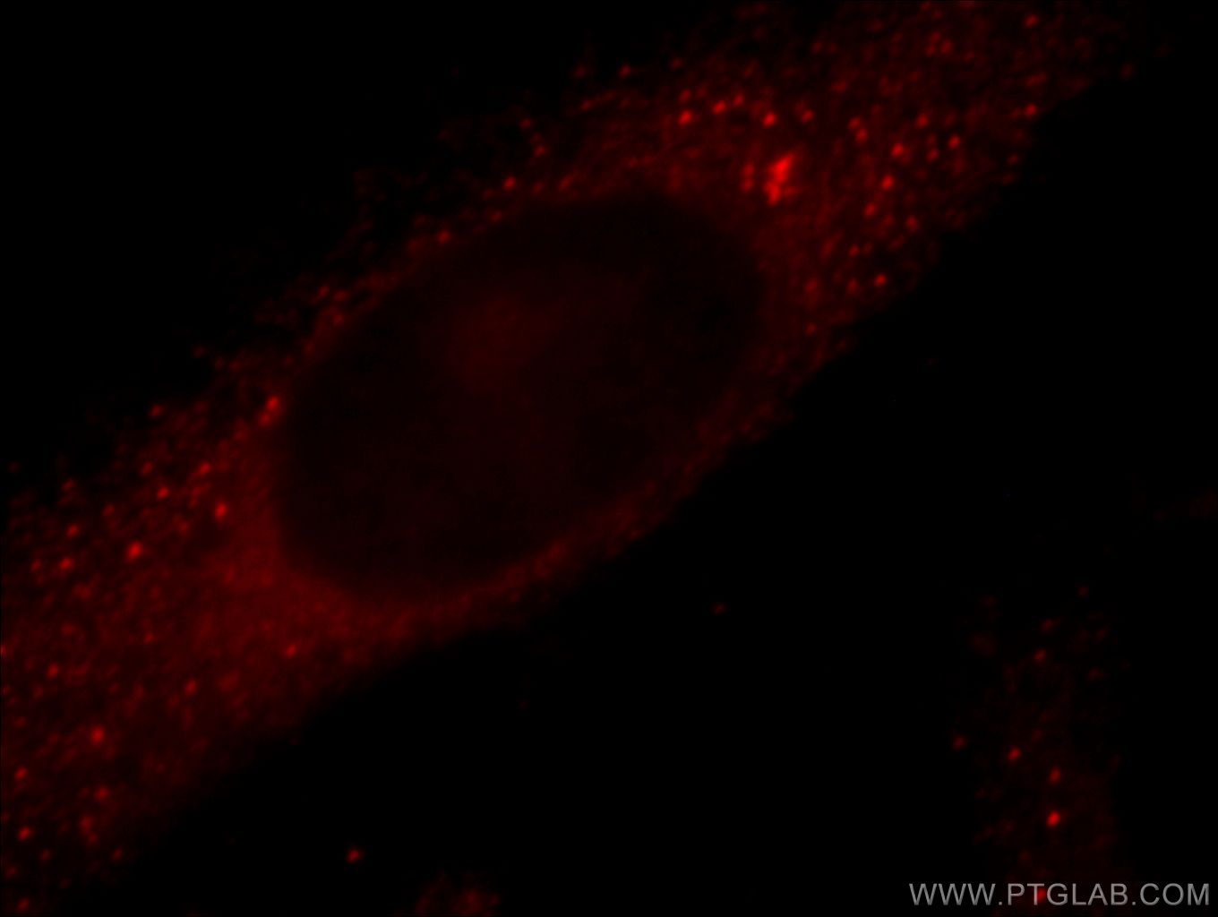 Immunofluorescence (IF) / fluorescent staining of HeLa cells using TRIM2 Polyclonal antibody (20356-1-AP)