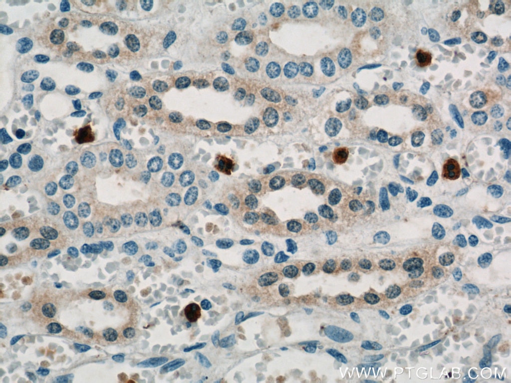 Immunohistochemistry (IHC) staining of human kidney tissue using TRIM2 Polyclonal antibody (20356-1-AP)