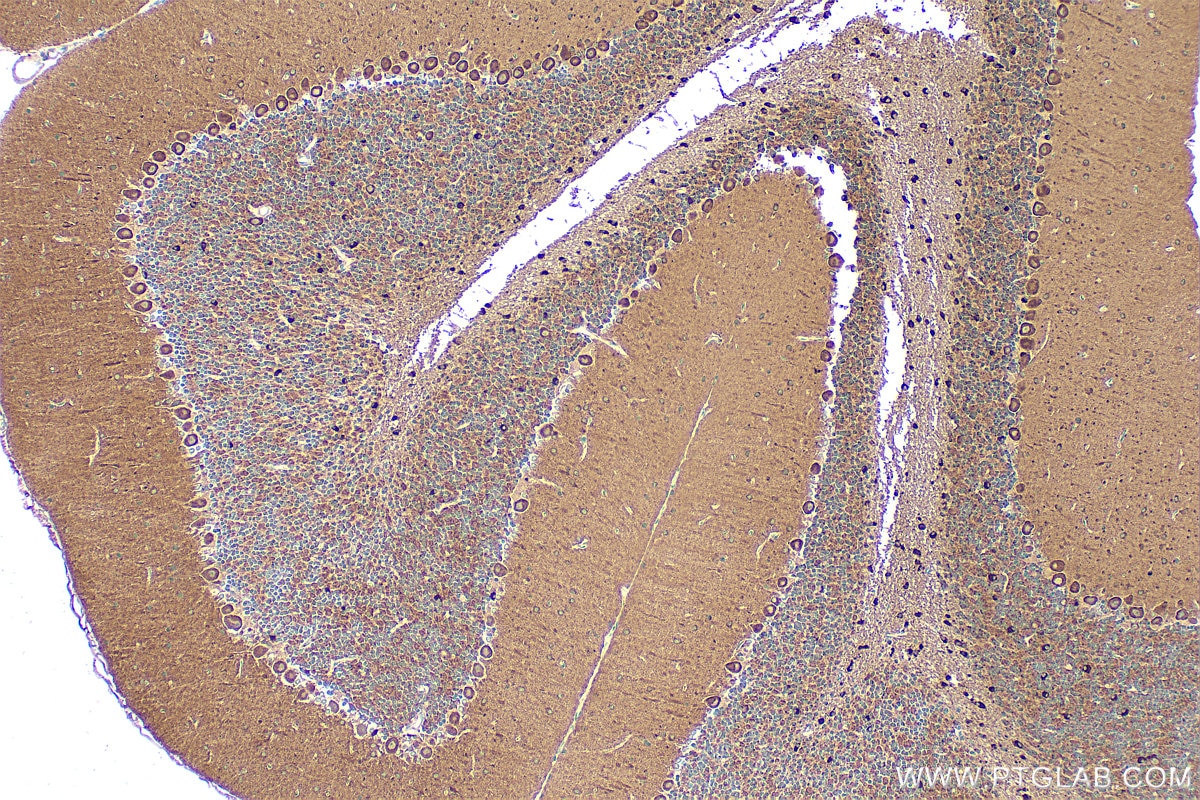 Immunohistochemistry (IHC) staining of mouse cerebellum tissue using TRIM2 Polyclonal antibody (20356-1-AP)