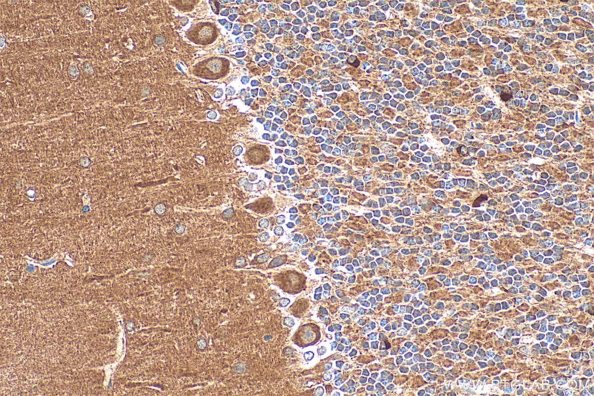 Immunohistochemistry (IHC) staining of mouse cerebellum tissue using TRIM2 Polyclonal antibody (20356-1-AP)