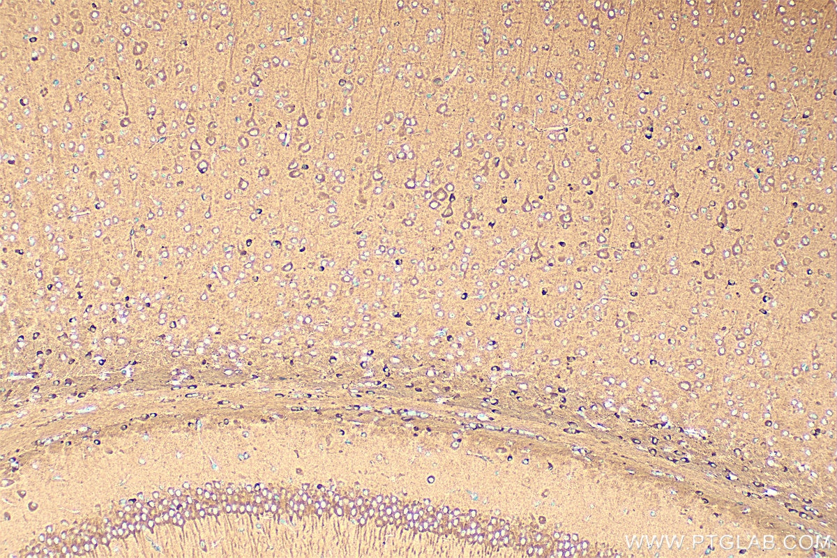 Immunohistochemistry (IHC) staining of mouse brain tissue using TRIM2 Polyclonal antibody (20356-1-AP)