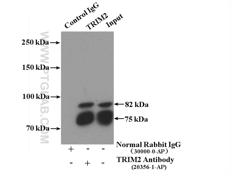 Immunoprecipitation (IP) experiment of mouse brain tissue using TRIM2 Polyclonal antibody (20356-1-AP)