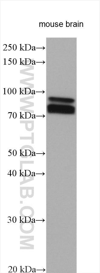 Western Blot (WB) analysis of various lysates using TRIM2 Polyclonal antibody (20356-1-AP)
