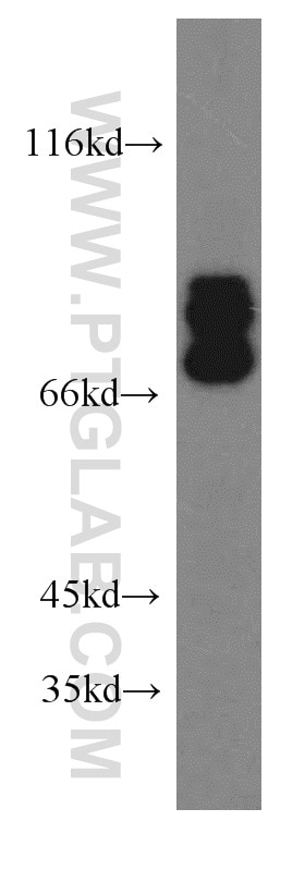 Western Blot (WB) analysis of mouse brain tissue using TRIM2 Polyclonal antibody (20356-1-AP)