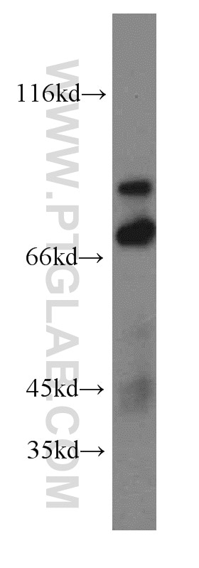 Western Blot (WB) analysis of mouse small intestine tissue using TRIM2 Polyclonal antibody (20356-1-AP)