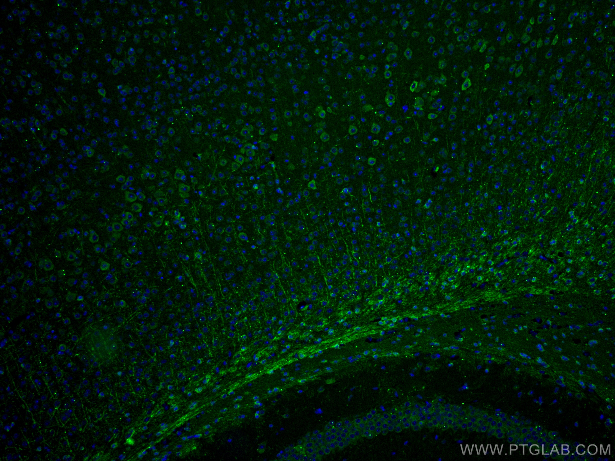 Immunofluorescence (IF) / fluorescent staining of mouse brain tissue using TRIM2 Monoclonal antibody (67342-1-Ig)