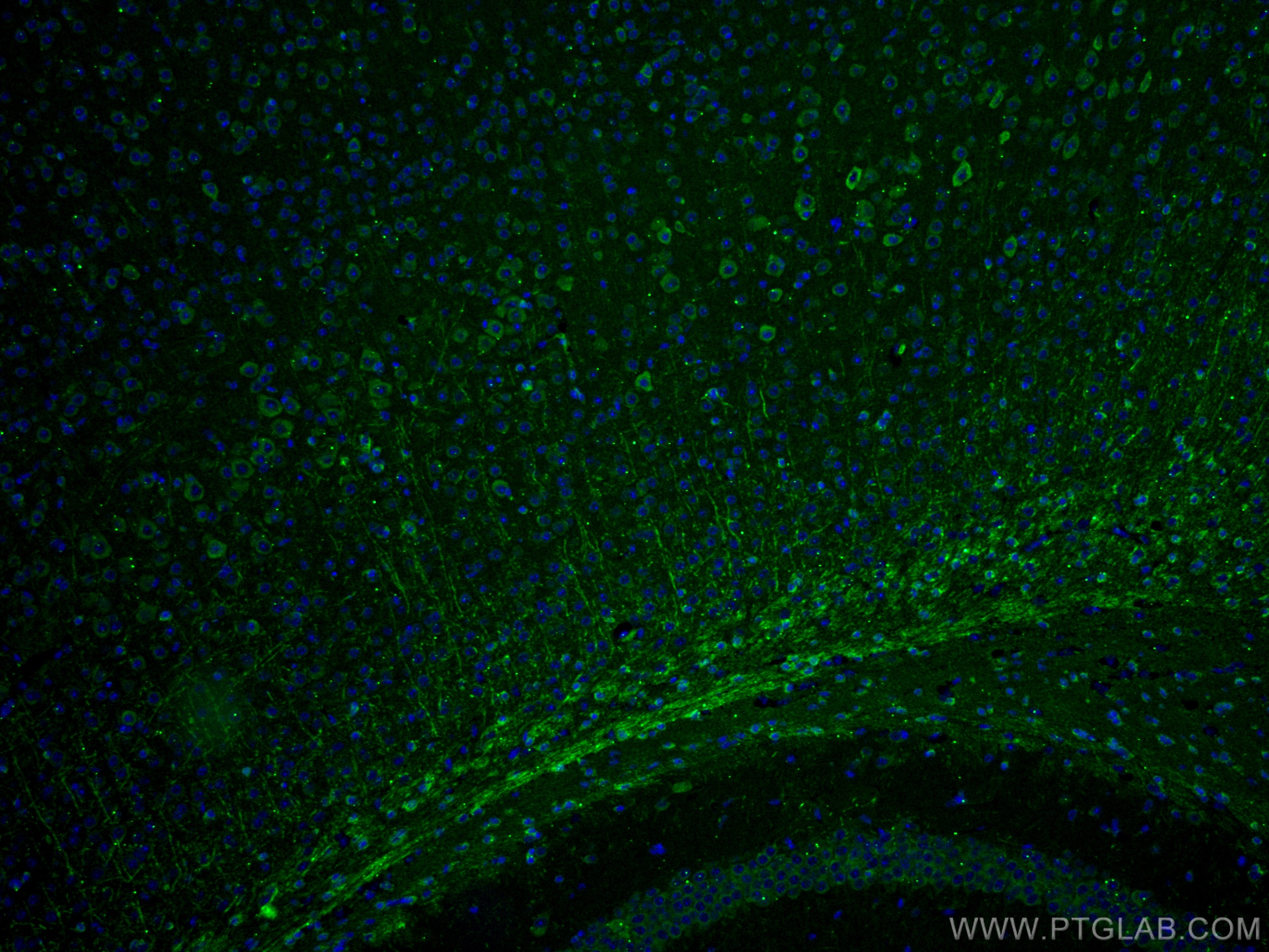Immunofluorescence (IF) / fluorescent staining of mouse brain tissue using TRIM2 Monoclonal antibody (67342-1-Ig)