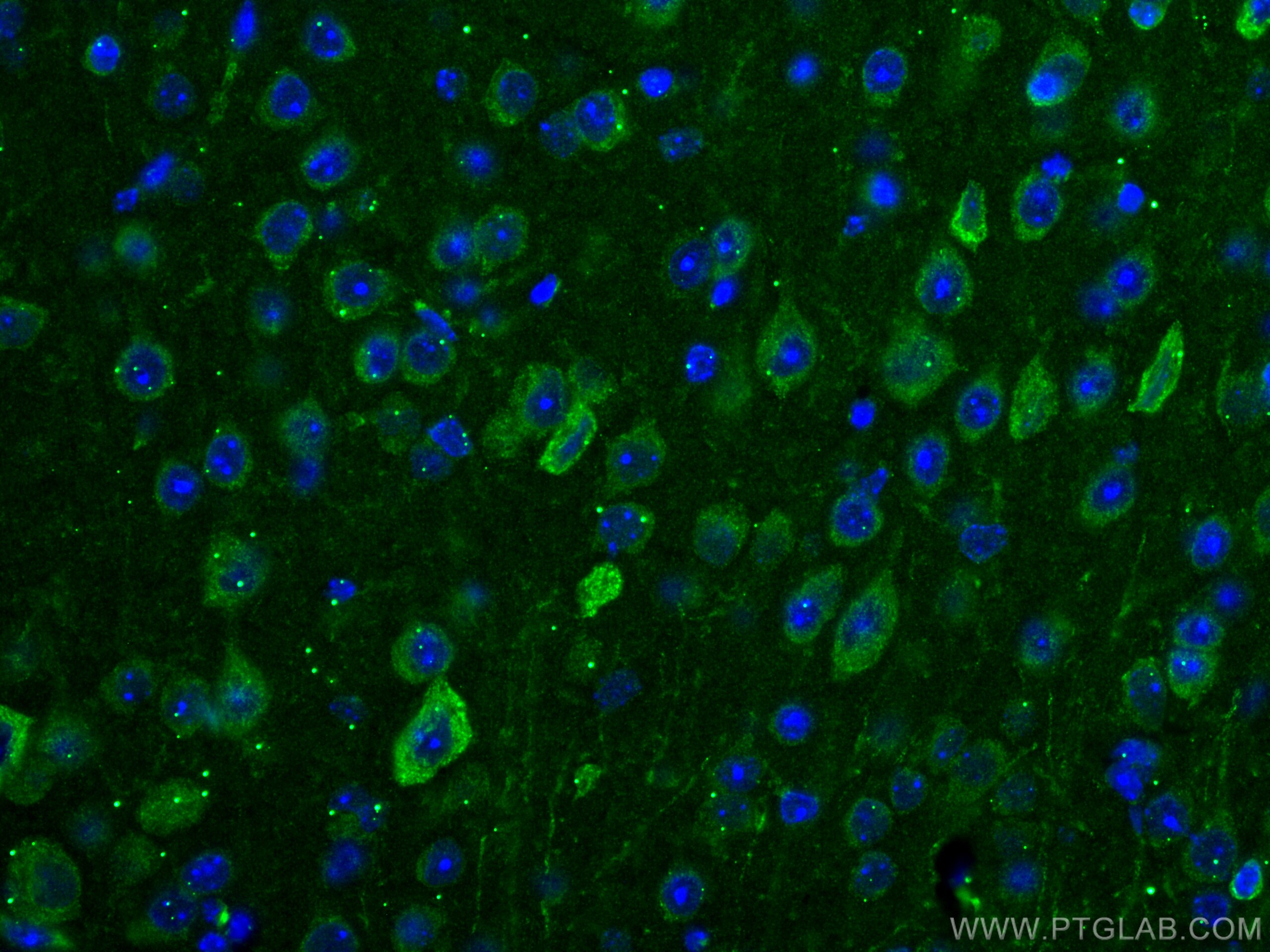 Immunofluorescence (IF) / fluorescent staining of mouse brain tissue using TRIM2 Monoclonal antibody (67342-1-Ig)