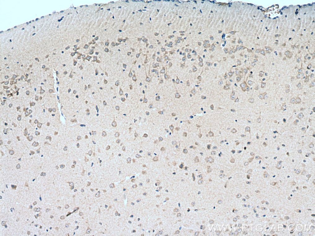 Immunohistochemistry (IHC) staining of mouse brain tissue using TRIM2 Monoclonal antibody (67342-1-Ig)