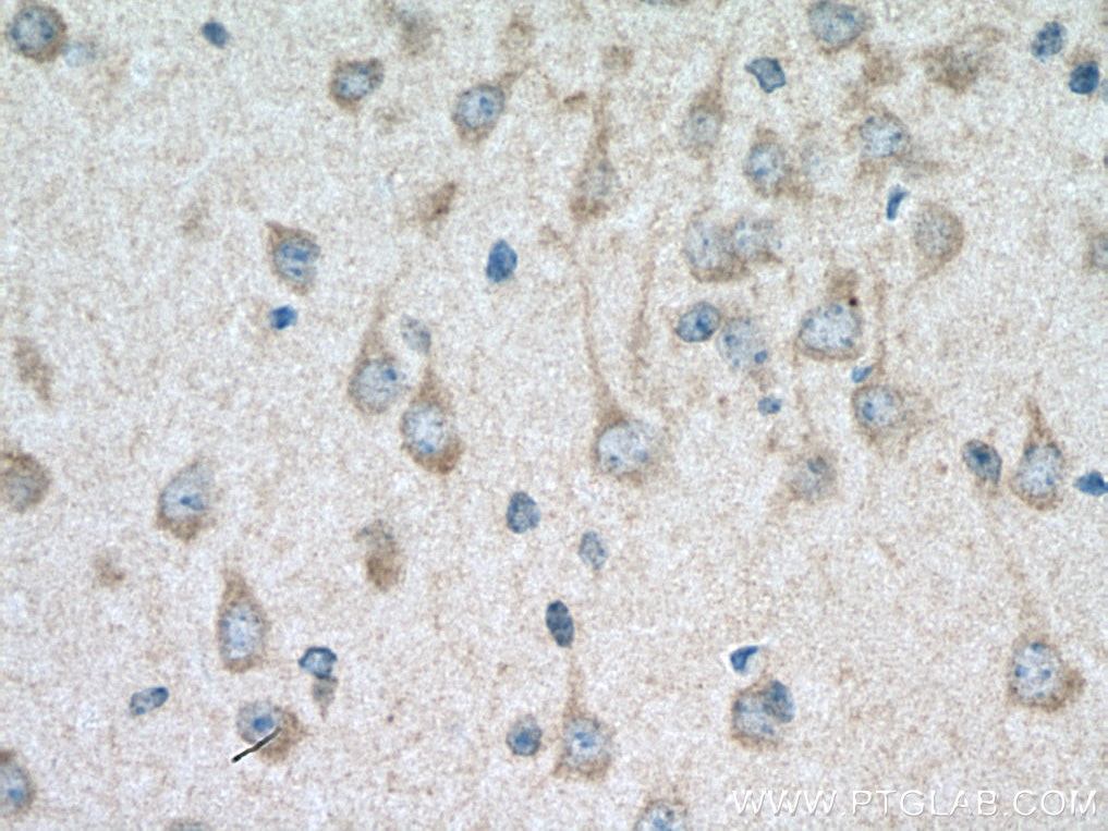 Immunohistochemistry (IHC) staining of mouse brain tissue using TRIM2 Monoclonal antibody (67342-1-Ig)