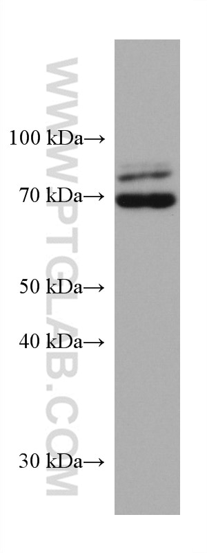 Western Blot (WB) analysis of rat brain tissue using TRIM2 Monoclonal antibody (67342-1-Ig)