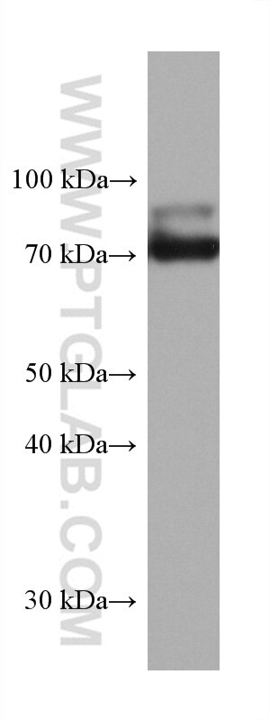 Western Blot (WB) analysis of mouse cerebellum tissue using TRIM2 Monoclonal antibody (67342-1-Ig)