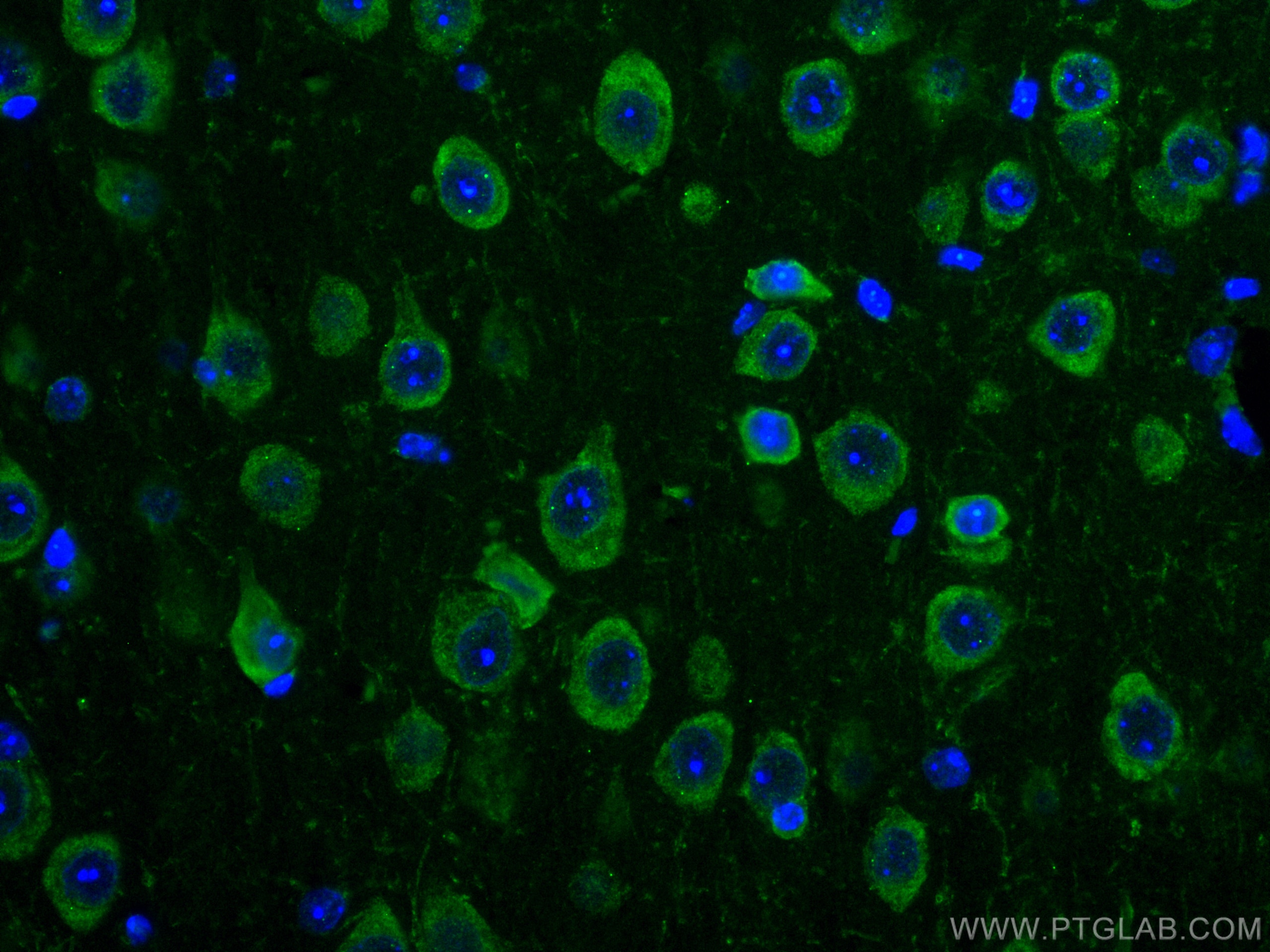 Immunofluorescence (IF) / fluorescent staining of mouse brain tissue using CoraLite® Plus 488-conjugated TRIM2 Monoclonal ant (CL488-67342)