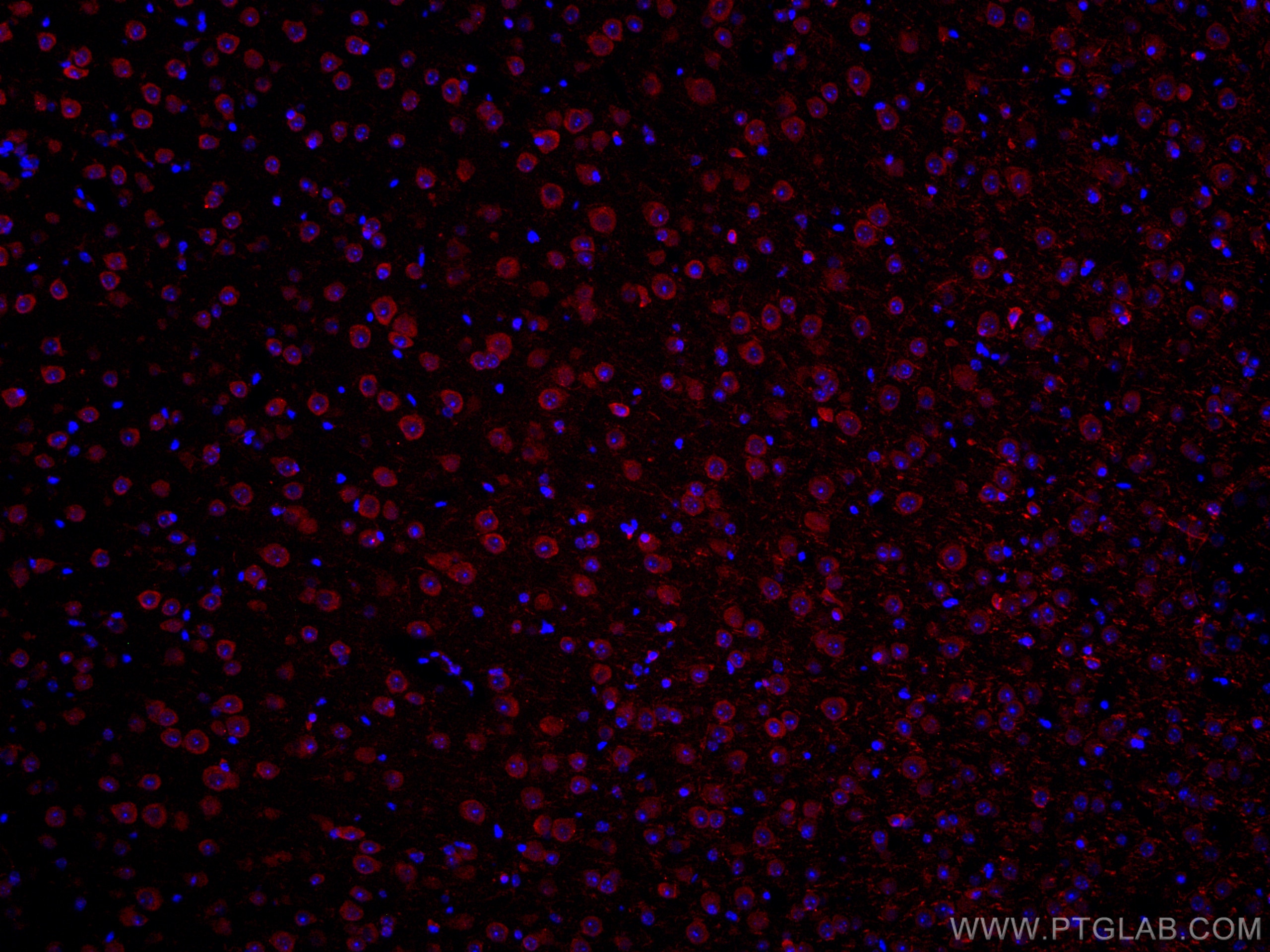 Immunofluorescence (IF) / fluorescent staining of mouse brain tissue using CoraLite®594-conjugated TRIM2 Monoclonal antibody (CL594-67342)