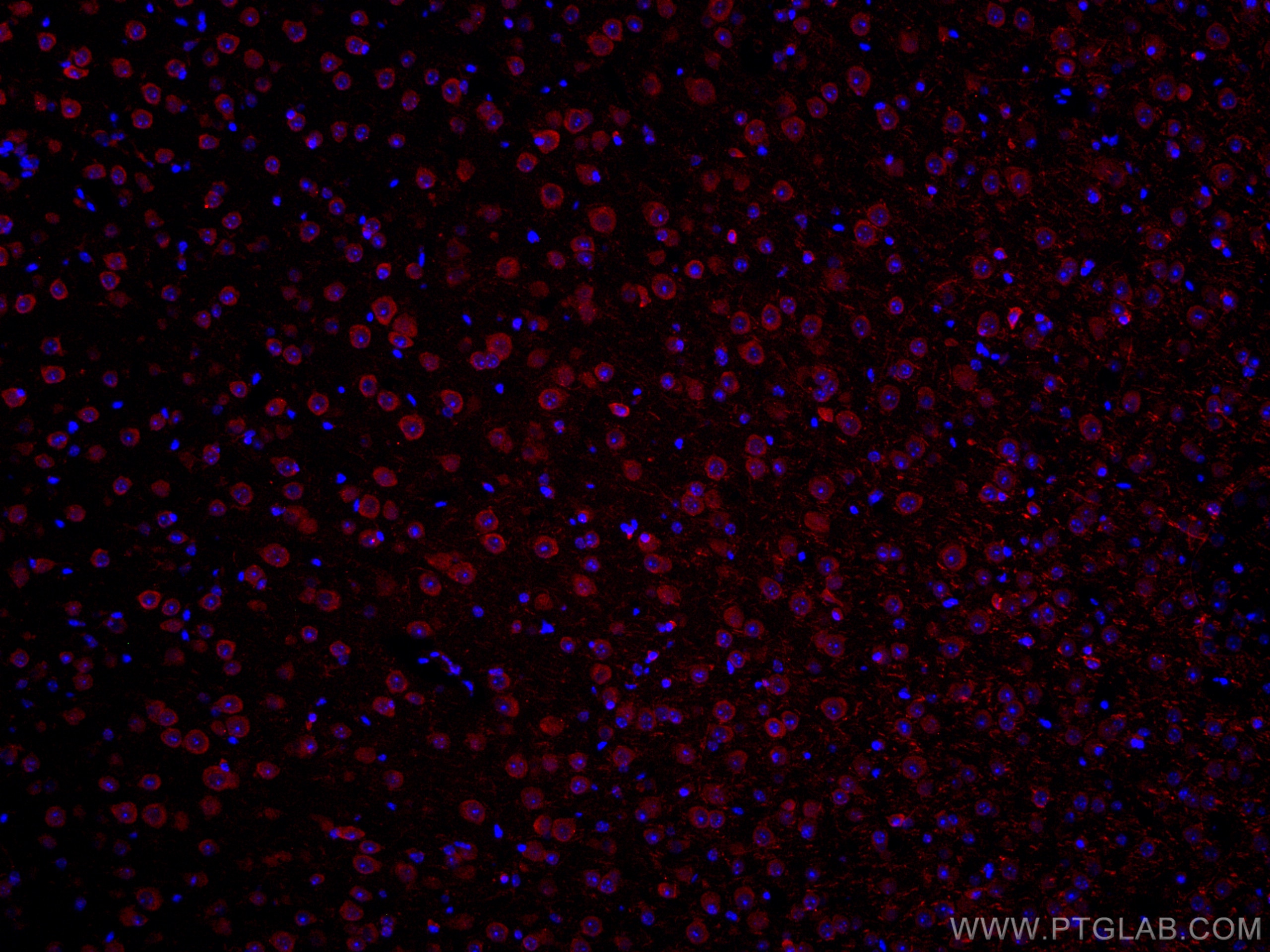 IF Staining of mouse brain using CL594-67342