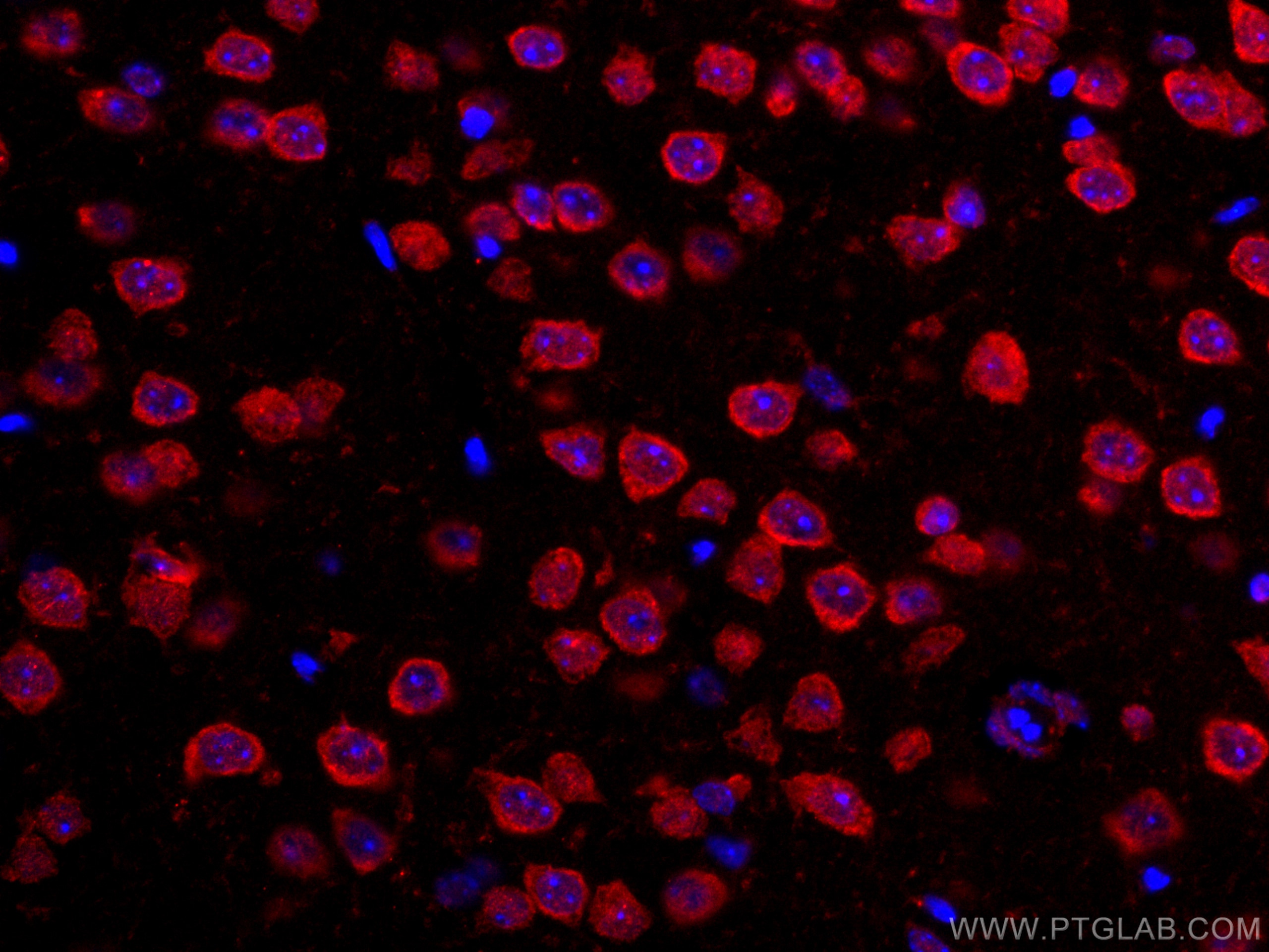 IF Staining of mouse brain using CL594-67342