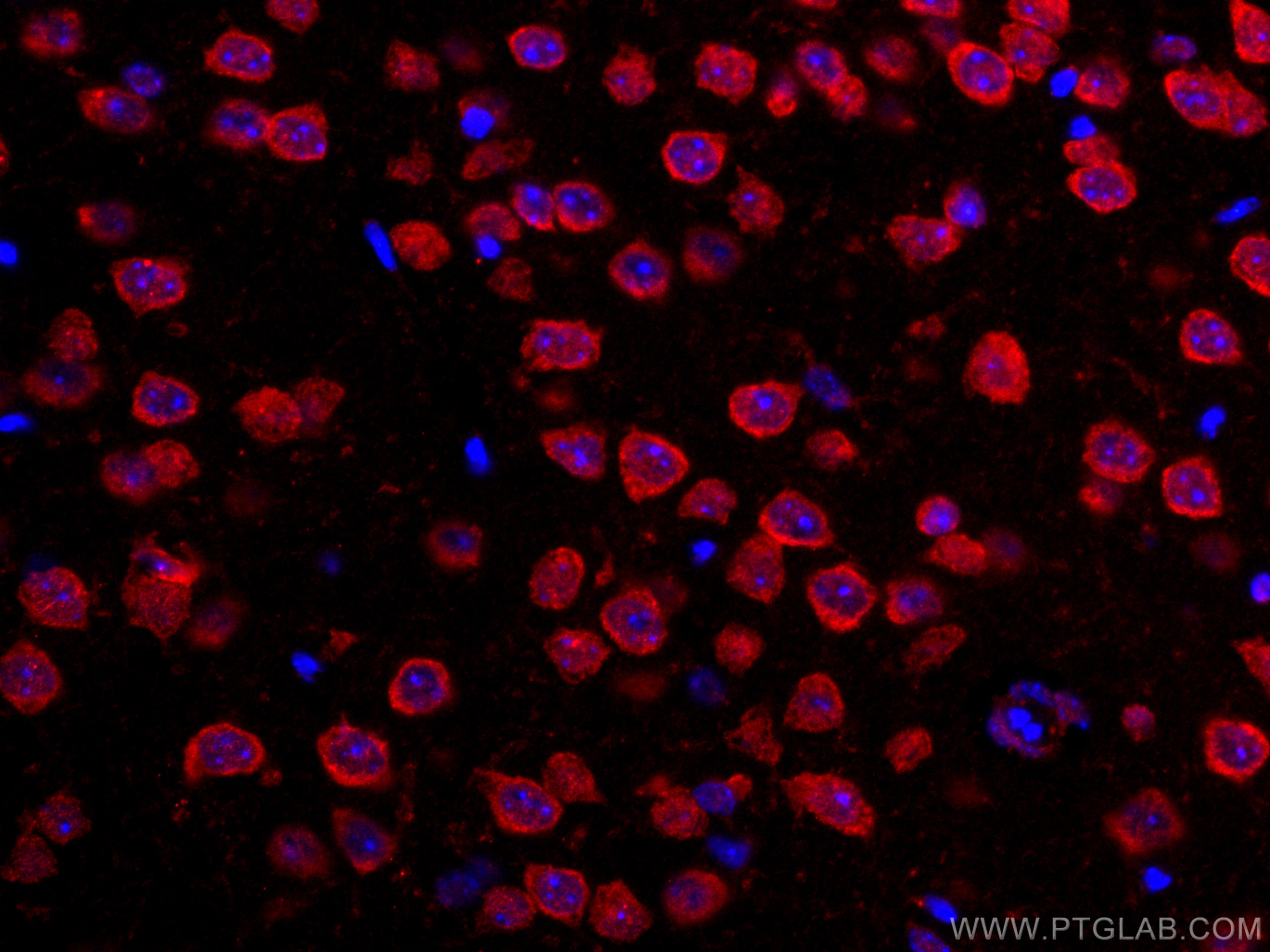 Immunofluorescence (IF) / fluorescent staining of mouse brain tissue using CoraLite®594-conjugated TRIM2 Monoclonal antibody (CL594-67342)