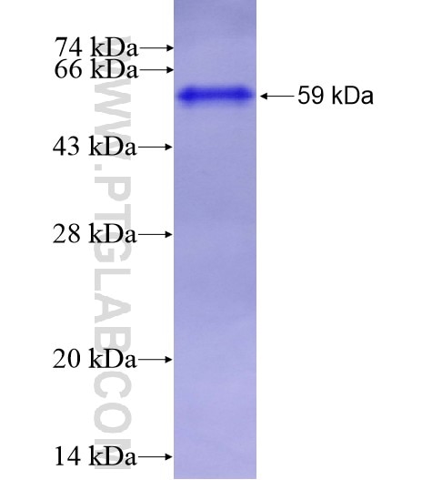 TRIM2 fusion protein Ag14208 SDS-PAGE