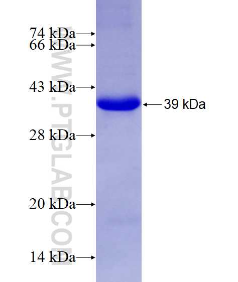 TRIM2 fusion protein Ag14637 SDS-PAGE