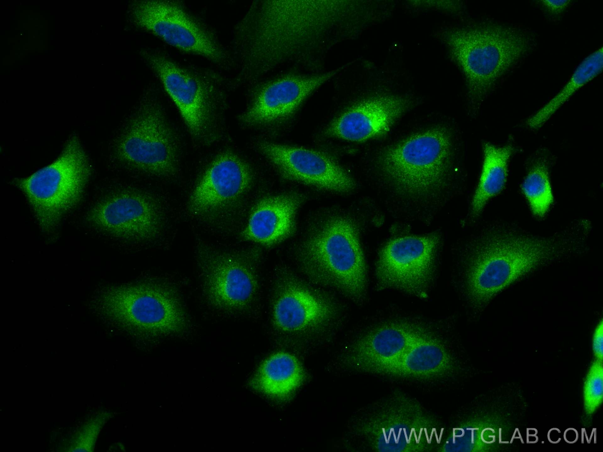 Immunofluorescence (IF) / fluorescent staining of A549 cells using TRIM21 Polyclonal antibody (12108-1-AP)