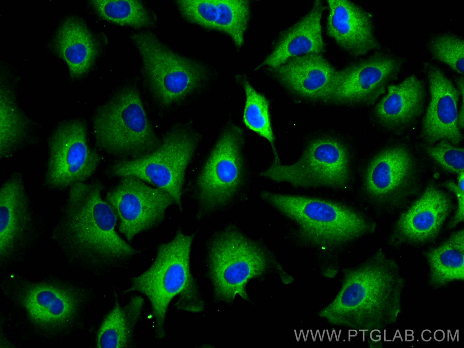Immunofluorescence (IF) / fluorescent staining of A549 cells using TRIM21 Polyclonal antibody (12108-1-AP)