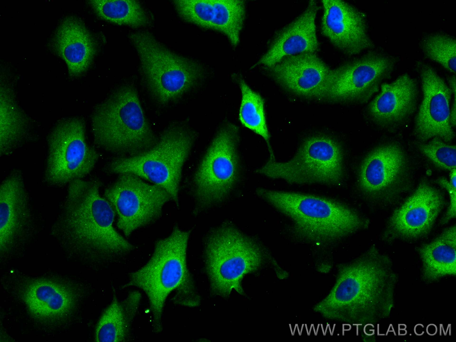 IF Staining of A549 using 12108-1-AP